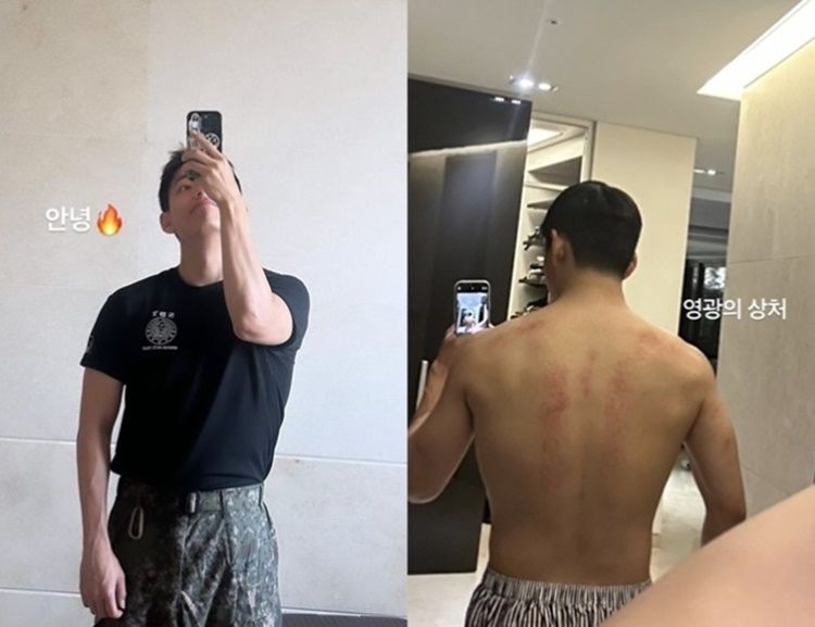 뷔 
