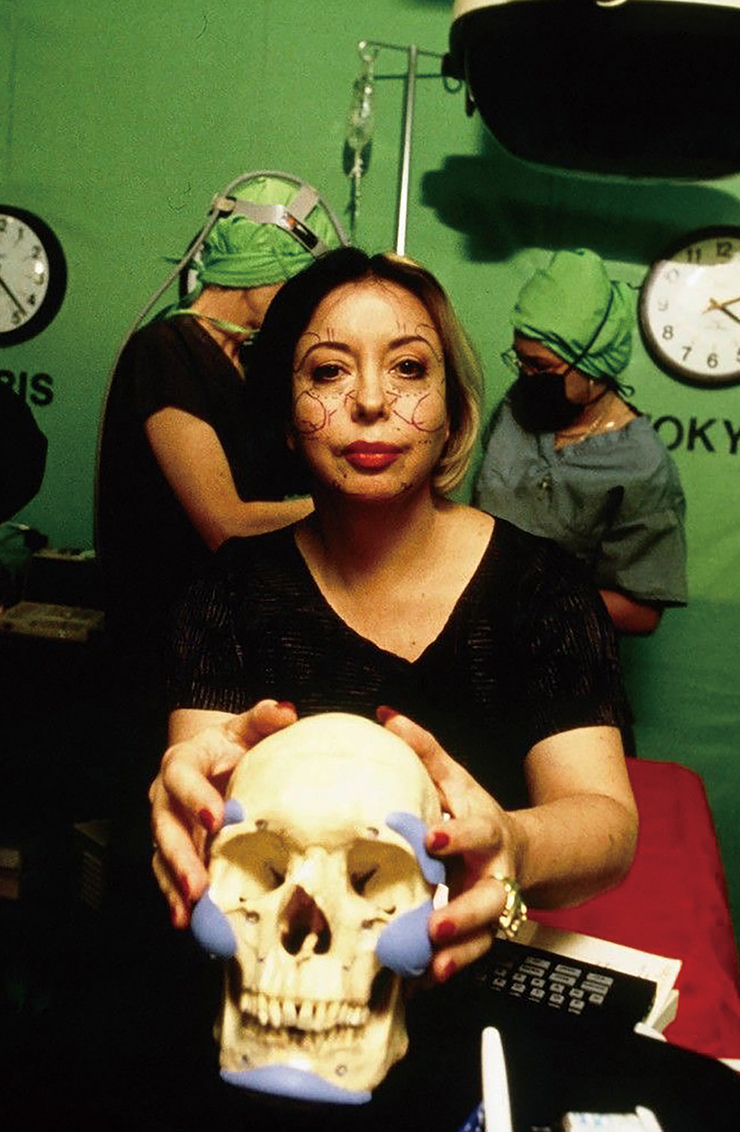 ‘Omnipresence-Surgery’(1993), Orlan.